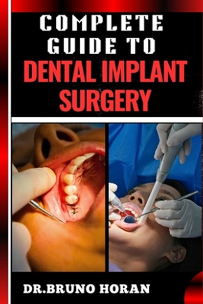 Complete Guide to Dental Implant Surgery: Comprehensive Manual To Advanced Techniques, Recovery, and Best Practices for Optimal Oral Health, Bruno Horan - Paperback - 9798328870153