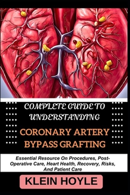 Complete Guide to Understanding Coronary Artery Bypass Grafting: Essential Resource On Procedures, Post-Operative Care, Heart Health, Recovery, Risks,, Klein Hoyle - Paperback - 9798328911313