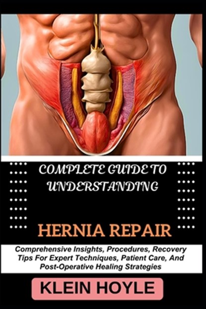 Complete Guide to Understanding Hernia Repair: Comprehensive Insights, Procedures, Recovery Tips For Expert Techniques, Patient Care, And Post-Operati, Klein Hoyle - Paperback - 9798329186574