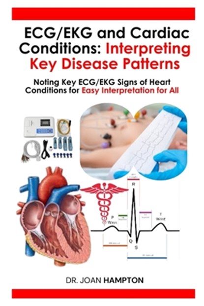 ECG/EKG and Cardiac Conditions: Interpreting Key Disease Patterns: Noting Key ECG/EKG Signs of Heart Conditions for Easy Interpretation for All, Joan Hampton - Paperback - 9798329236422