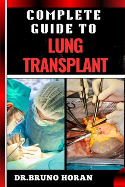 Complete Guide to Lung Transplant: Essential Handbook To Surgery Procedures, Recovery Strategies, Risks & Benefits, Patient Success Stories, and Lates, Bruno Horan - Paperback - 9798333107824