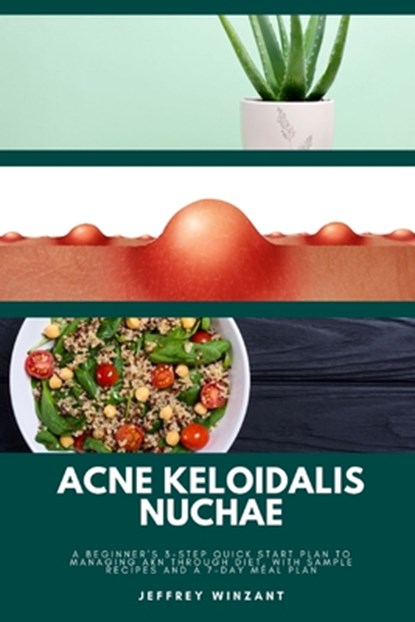 Acne Keloidalis Nuchae: A Beginner's 3-Step Quick Start Plan to Managing AKN Through Diet, With Sample Recipes and a 7-Day Meal Plan, Jeffrey Winzant - Paperback - 9798348440602
