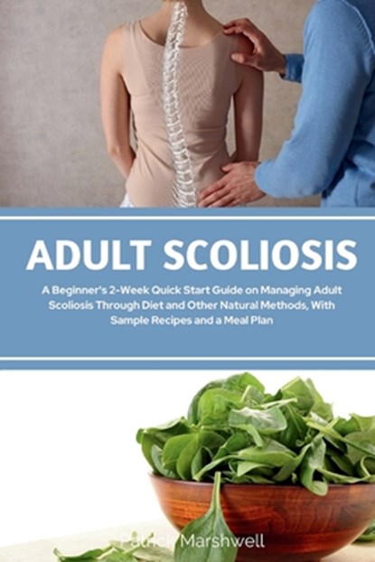 Adult Scoliosis: A Beginner's 2-Week Quick Start Guide on Managing Adult Scoliosis Through Diet and Other Natural Methods, With Sample Recipes and a M, Patrick Marshwell - Paperback - 9798348590598
