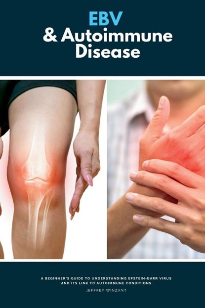 EBV & Autoimmune Disease, Jeffrey Winzant - Paperback - 9798349227738
