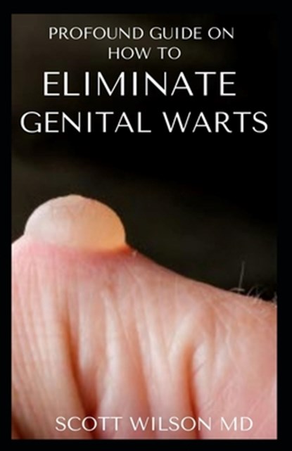 Profound Guide to Eliminate Genital Warts: The Ultimate Guide To Eliminate Genital Warts, Scott Wilson - Paperback - 9798554339066