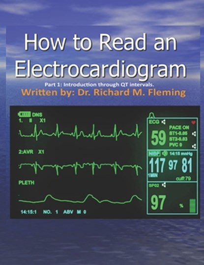 How to Read an Electrocardiogram., Richard M. Fleming - Paperback - 9798563970885