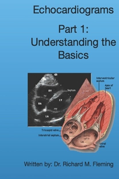 Echocardiograms - Part 1: Understanding the Basics., Richard M. Fleming - Paperback - 9798569143924