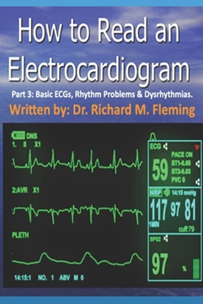 How to Read an Electrocardiogram - Part 3: Basic ECGs, Rhythm Problems & Dysrhythmias., Richard M. Fleming - Paperback - 9798569580408