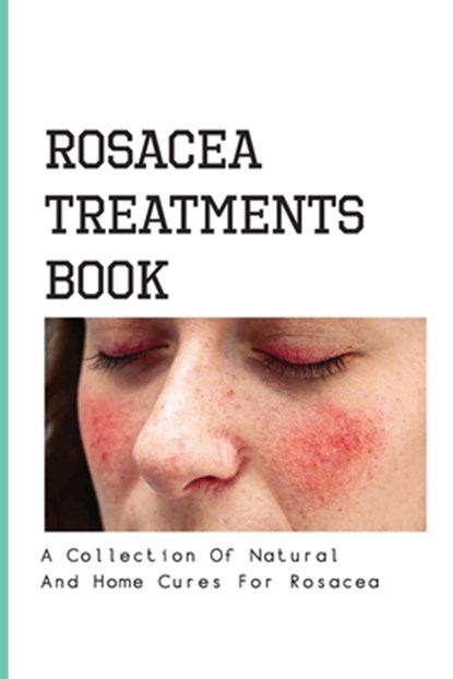 Rosacea Treatments Book- A Collection Of Natural And Home Cures For Rosacea: Rosacea Treatment, Merlin Diskind - Paperback - 9798579261052