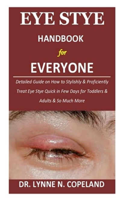 Eye Stye Handbook for Everyone: Detailed Guide on How to Stylishly & Proficiently Treat Eye Stye Quick in Few Days for Toddlers & Adults & So Much Mor, Lynne N. Copeland - Paperback - 9798658818245