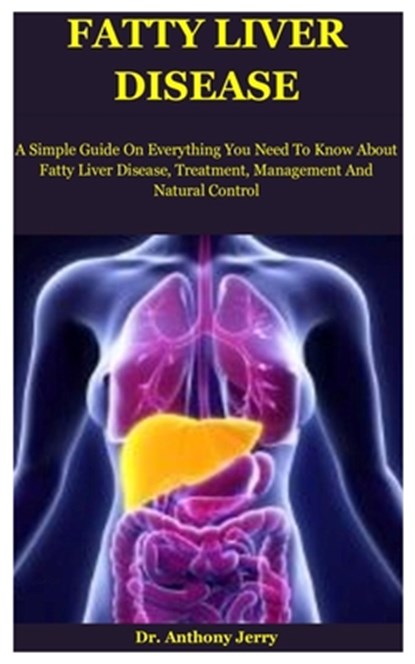 Fatty Liver Disease, Dr Anthony Jerry - Paperback - 9798686511682