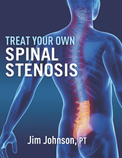 Treat Your Own Spinal Stenosis, Pt Jim Johnson - Paperback - 9798718988444