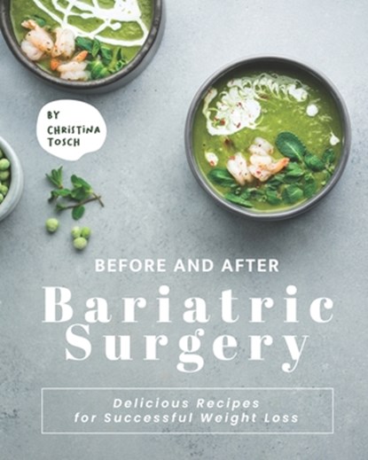 Before and After Bariatric Surgery, Christina Tosch - Paperback - 9798731528627