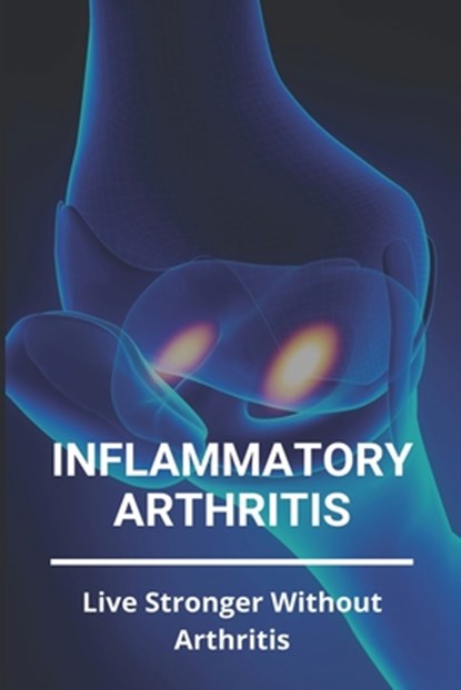 Inflammatory Arthritis: Live Stronger Without Arthritis: Rheumatoid Arthritis Ppt, Cristopher Carrizales - Paperback - 9798733816562