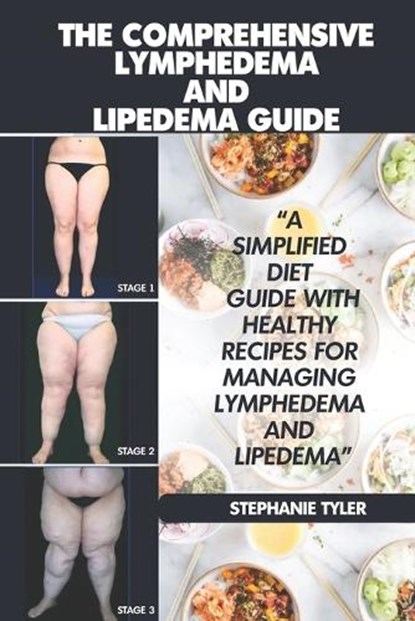 The Comprehensive Lymphedema and Lipedema Guide, TYLER,  Stephanie - Paperback - 9798844297168