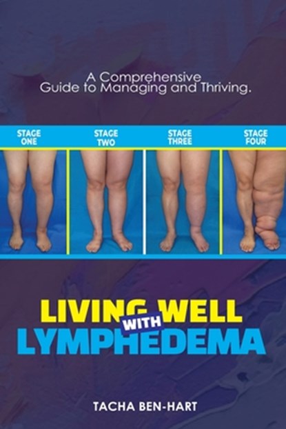 Living Well with Lymphedema: A Comprehensive Guide to Managing and Thriving, Tacha Ben-Hart - Paperback - 9798853361881
