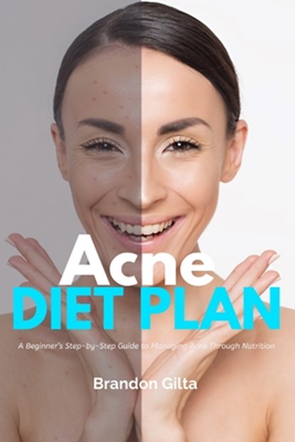 Acne Diet Plan: A Beginner's Step-by-Step Guide to Managing Acne Through Nutrition With Curated Recipes and a Sample Meal Plan, Brandon Gilta - Paperback - 9798869134127