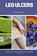 Leg Ulcers, Patrick Marshwell - Paperback - 9798869173935