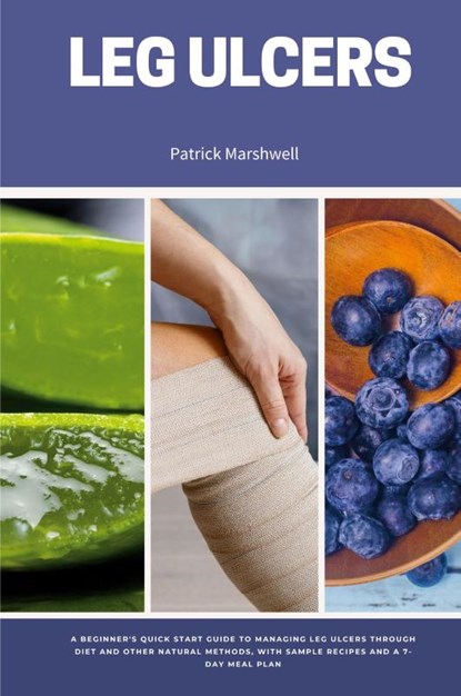 Leg Ulcers, Patrick Marshwell - Paperback - 9798869173935