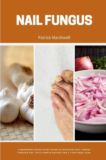 Nail Fungus, Patrick Marshwell - Paperback - 9798869215055