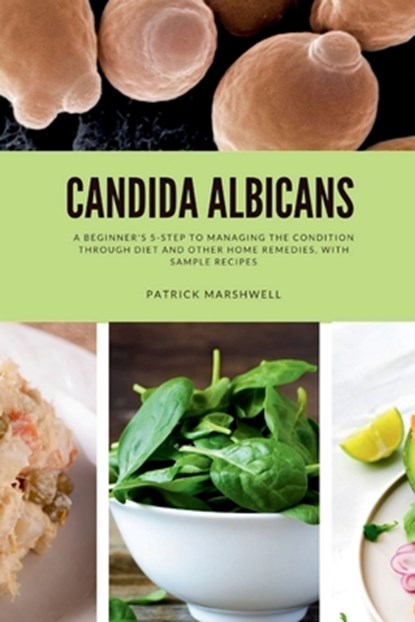 Candida Albicans: A Beginner's 5-Step to Managing the Condition Through Diet and Other Home Remedies, With Sample Recipes, Patrick Marshwell - Paperback - 9798869285515