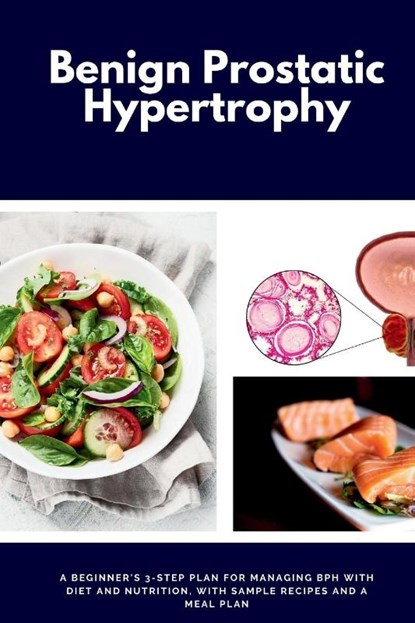 Benign Prostatic Hypertrophy, Larry Jamesonn - Paperback - 9798869395955