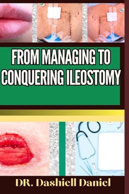 From Managing to Conquering Ileostomy: Expert Guide To Understanding the Causes, Recognizing Symptoms, Prevention and Embracing Effective Treatments f, Dashiell Daniel - Paperback - 9798873239795