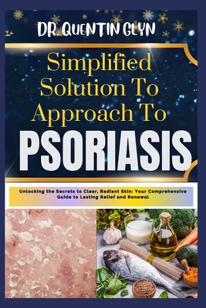 Simplified Solution Approach To PSORIASIS: Unlocking the Secrets to Clear, Radiant Skin: Your Comprehensive Guide to Lasting Relief and Renewal, Quentin Glyn - Paperback - 9798876658340