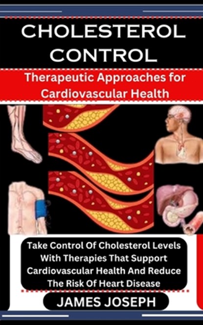 Cholesterol Control: Therapeutic Approaches for Cardiovascular Health: Take Control Of Cholesterol Levels With Therapies That Support Cardi, James Joseph - Paperback - 9798876834461