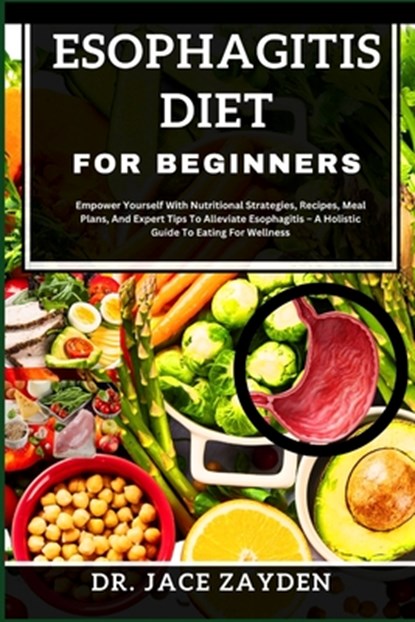 Esophagitis Diet for Beginners: Empower Yourself With Nutritional Strategies, Recipes, Meal Plans, And Expert Tips To Alleviate Esophagitis - A Holist, Jace Zayden - Paperback - 9798877508583