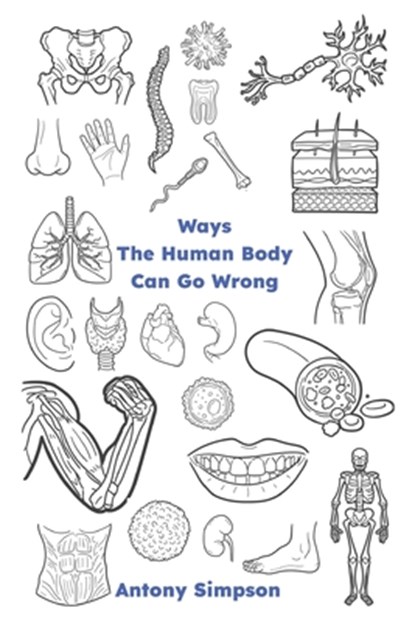 Ways The Human Body Can Go Wrong, Antony Simpson - Paperback - 9798882511493