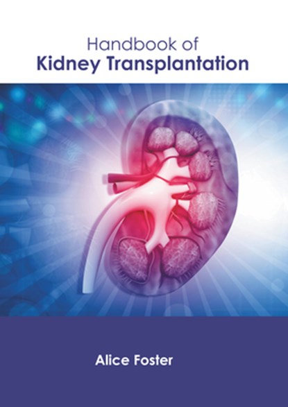 Handbook of Kidney Transplantation, Alice Foster - Gebonden - 9798887401485
