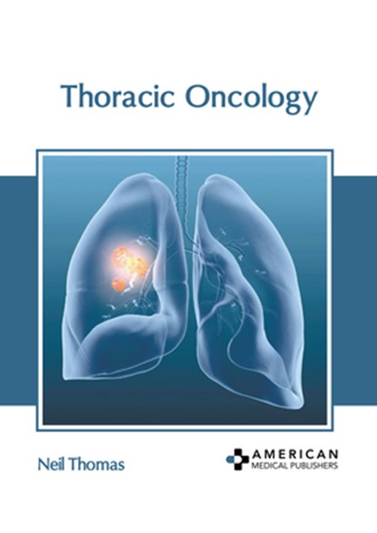 Thoracic Oncology, Neil Thomas - Gebonden - 9798887405711
