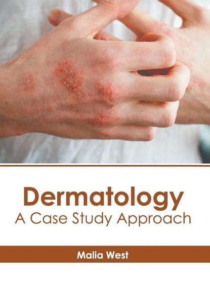 Dermatology: A Case Study Approach, Malia West - Gebonden - 9798887406343