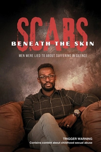 Scars Beneath the Skin, Smith Paul - Paperback - 9798901900413