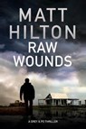 Raw Wounds - Matt Hilton - 9781847518118
