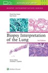 Biopsy Interpretation of the Lung - DAVID ILAN SUSTER ; SAUL SUSTER - 9781975240677