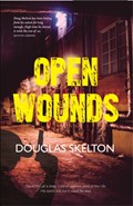 Open Wounds | Douglas Skelton | 