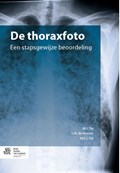 De thoraxfoto | M.J. Tip ; S.M. Hosson ; M.E.J. Pijl | 