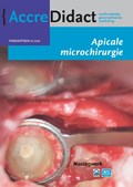Apicale microchirurgie | Fenneke Dommering | 