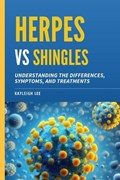 Herpes Versus Shingles | Kayleigh Lee | 