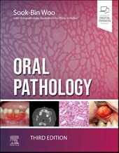 Oral Pathology