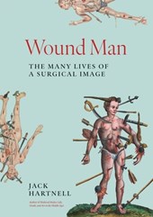 Wound Man