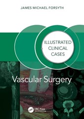 Vascular Surgery: