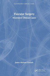 Vascular Surgery: