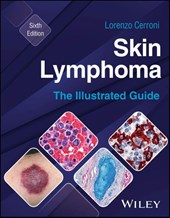 Skin Lymphoma