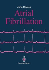 Atrial Fibrillation