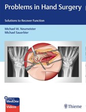 Problems in Hand Surgery