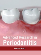 Advanced Research in Periodontitis