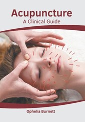 Acupuncture: A Clinical Guide